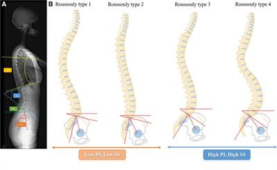 The relationship between spino-pelvic alignment and primary dysmenorrhea